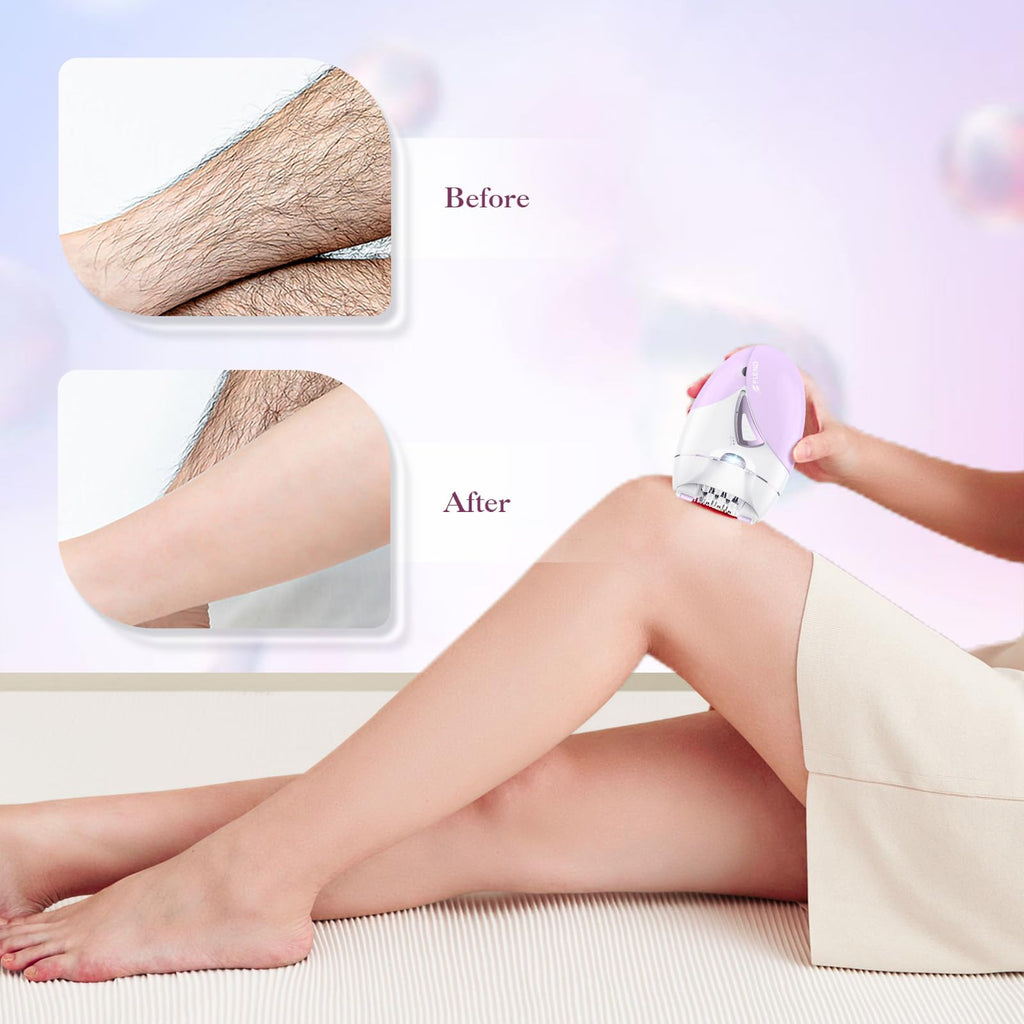 2-Speed Adjustable Epilator with 36 Tweezers A1828